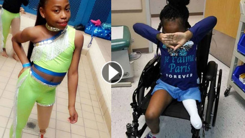 فيديو مذهل: طفلة تتحدى الاعاقة وترقص بساقها الصناعية بدلا من المبتورة 